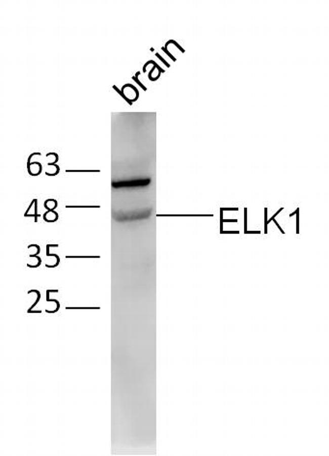 ELK1 Antibody in Western Blot (WB)