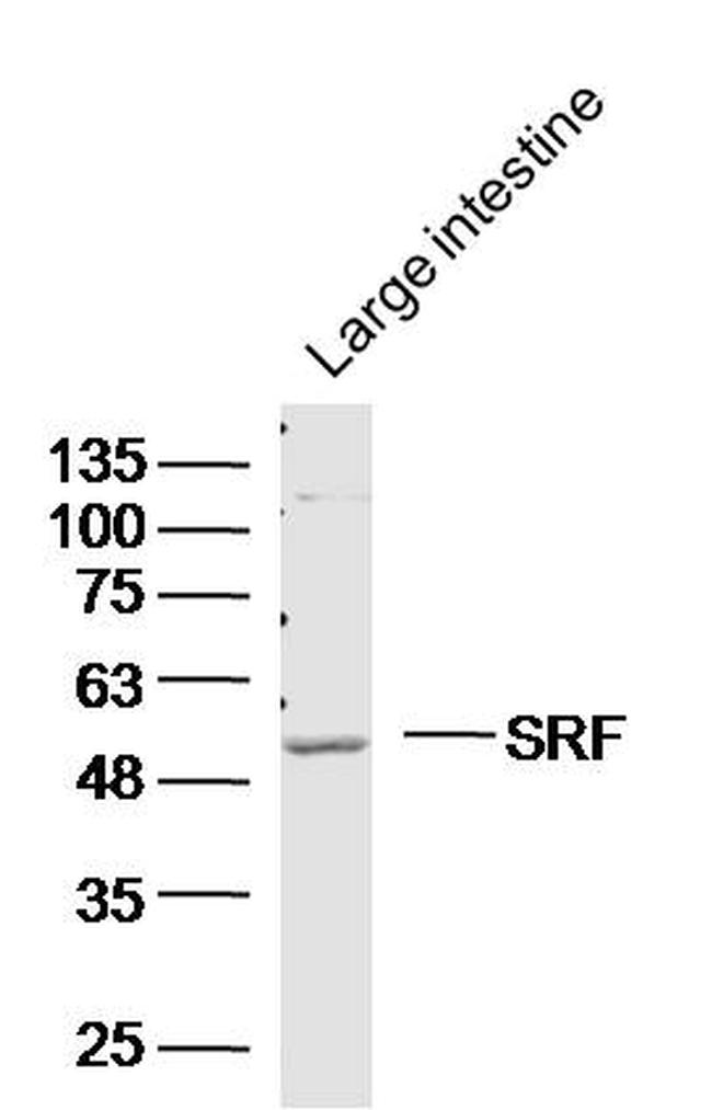 SRF Antibody in Western Blot (WB)