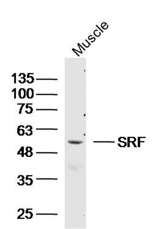 SRF Antibody in Western Blot (WB)