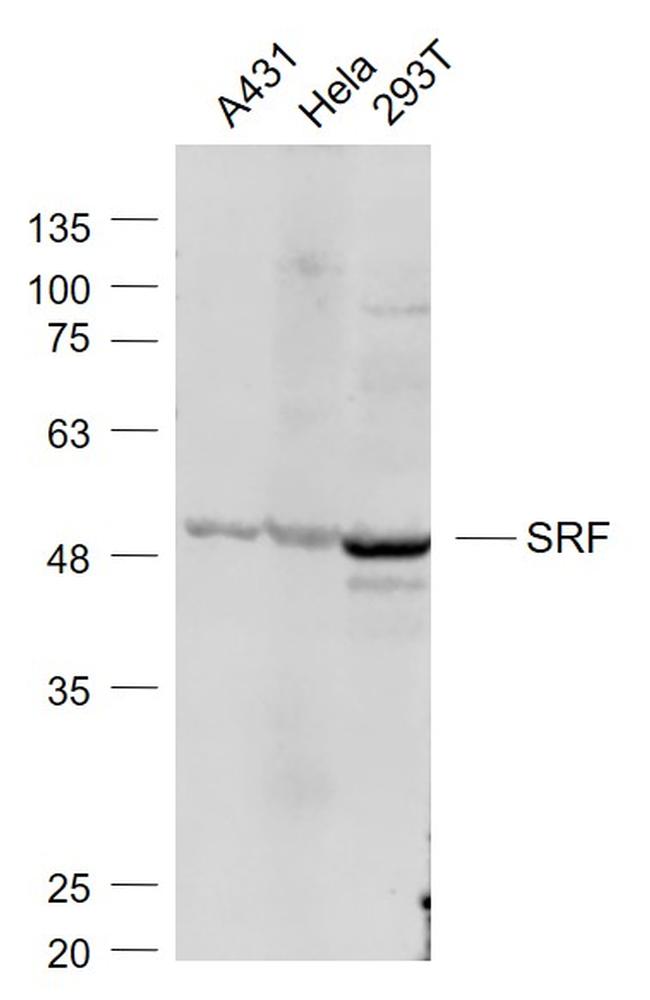 SRF Antibody in Western Blot (WB)