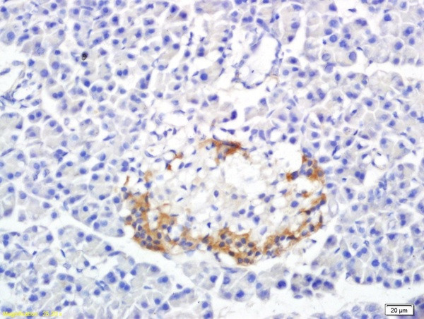 SREBP-1/2 Antibody in Immunohistochemistry (Paraffin) (IHC (P))