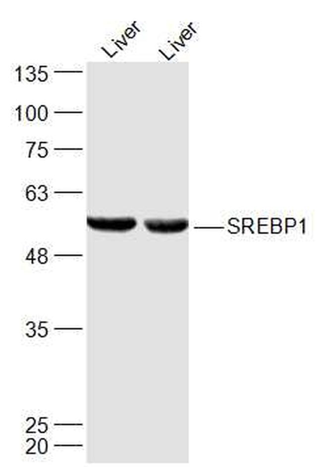 SREBP-1/2 Antibody in Western Blot (WB)