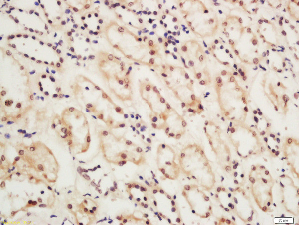 ERCC6 Antibody in Immunohistochemistry (Paraffin) (IHC (P))