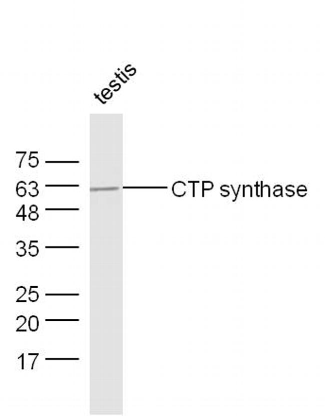 CTP synthase 1 Antibody in Western Blot (WB)