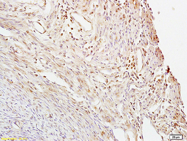 CTBP1 Antibody in Immunohistochemistry (Paraffin) (IHC (P))