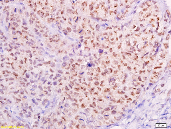 MTA1 Antibody in Immunohistochemistry (Paraffin) (IHC (P))