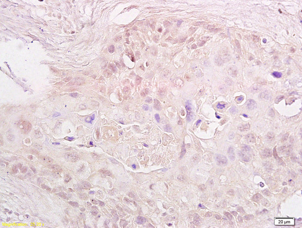 MTA1 Antibody in Immunohistochemistry (Paraffin) (IHC (P))