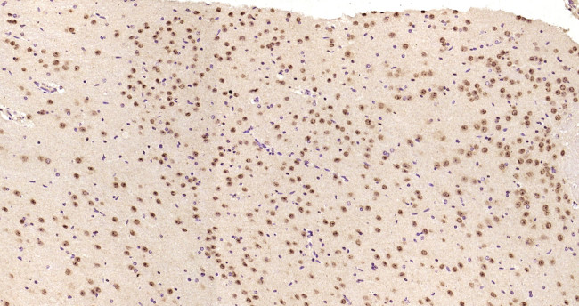 MTA1 Antibody in Immunohistochemistry (Paraffin) (IHC (P))