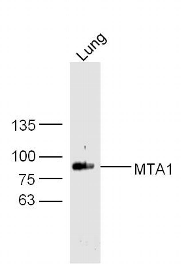 MTA1 Antibody in Western Blot (WB)