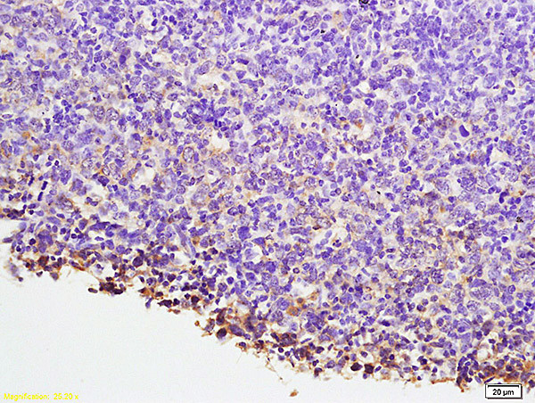 NFAT2 Antibody in Immunohistochemistry (Paraffin) (IHC (P))