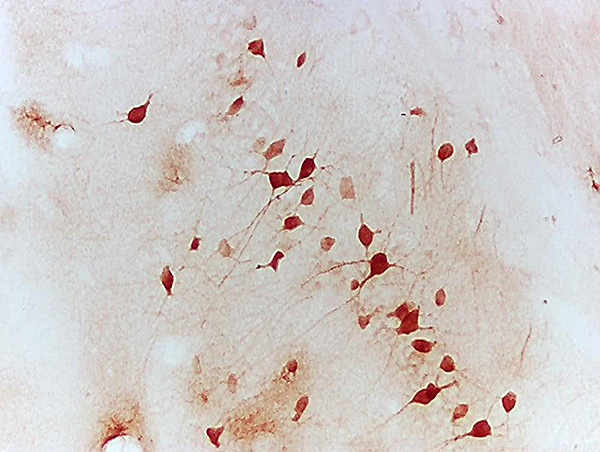 NFAT2 Antibody in Immunohistochemistry (Paraffin) (IHC (P))