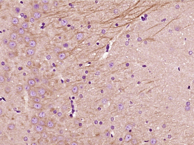 NFAT2 Antibody in Immunohistochemistry (Paraffin) (IHC (P))