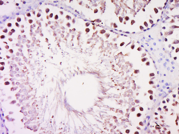 DALRD3 Antibody in Immunohistochemistry (Paraffin) (IHC (P))