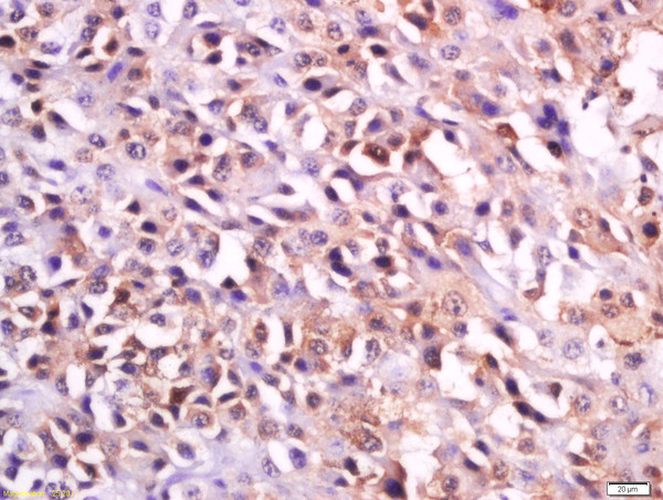 MC-1R/MC1 Receptor Antibody in Immunohistochemistry (Paraffin) (IHC (P))