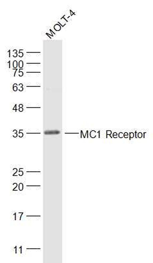 MC-1R/MC1 Receptor Antibody in Western Blot (WB)