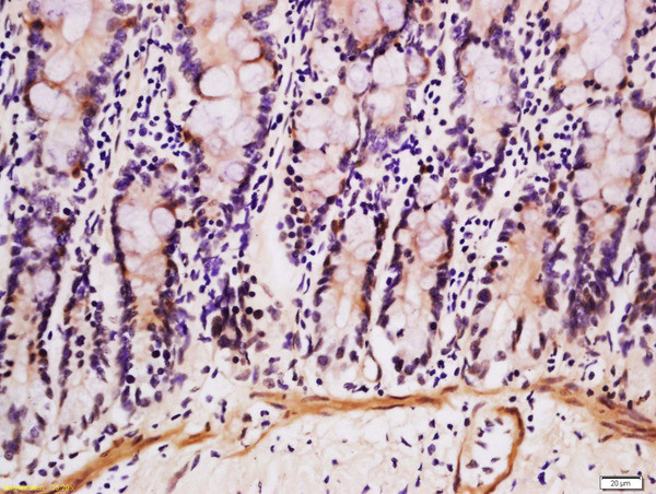 DEFB124 Antibody in Immunohistochemistry (Paraffin) (IHC (P))