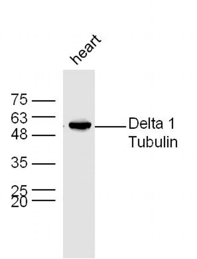 Delta 1 Tubulin Antibody in Western Blot (WB)