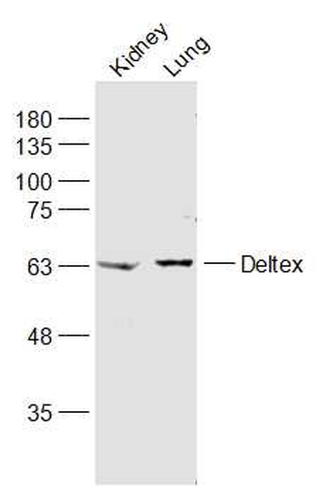 Deltex Antibody in Western Blot (WB)