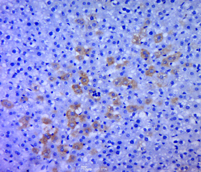 RPS6KB1 Antibody in Immunohistochemistry (Paraffin) (IHC (P))