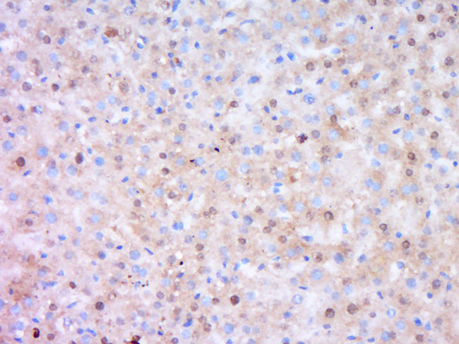 DENND4B Antibody in Immunohistochemistry (Paraffin) (IHC (P))