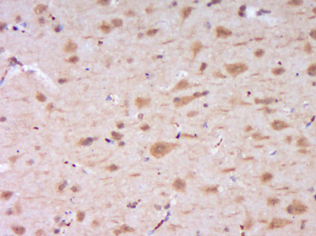 DENND4B Antibody in Immunohistochemistry (Paraffin) (IHC (P))