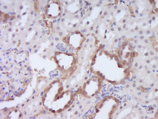 DENND4B Antibody in Immunohistochemistry (Paraffin) (IHC (P))