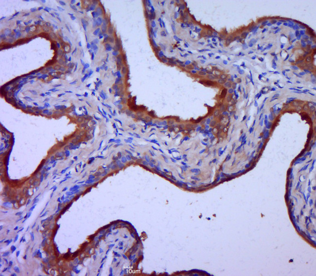 Claudin 1 Antibody in Immunohistochemistry (Paraffin) (IHC (P))