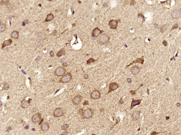 DGKZ Antibody in Immunohistochemistry (Paraffin) (IHC (P))