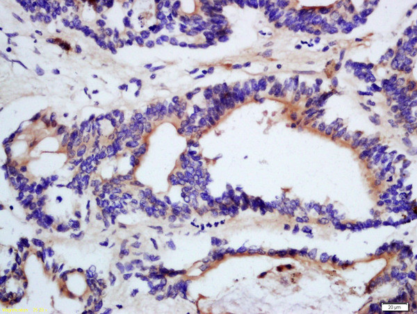 DHDH Antibody in Immunohistochemistry (Paraffin) (IHC (P))