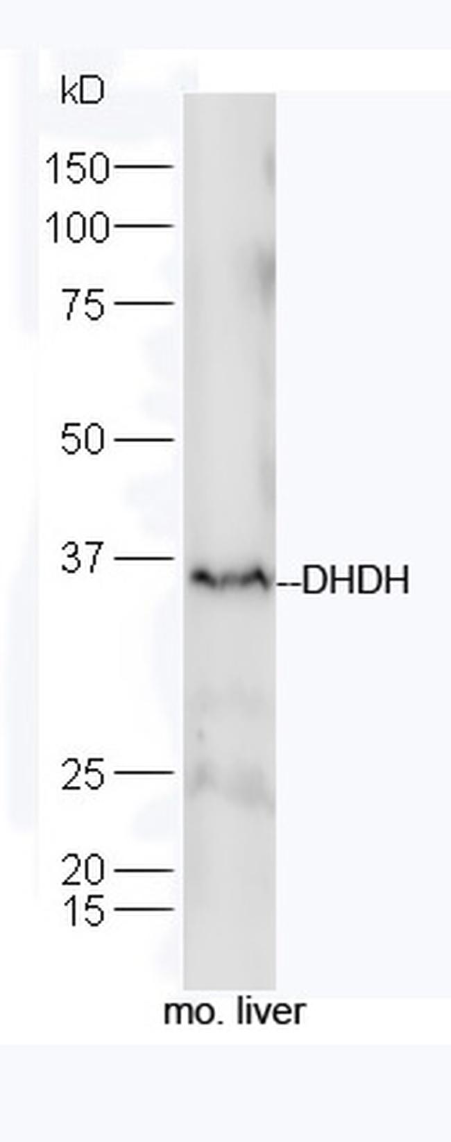 DHDH Antibody in Western Blot (WB)