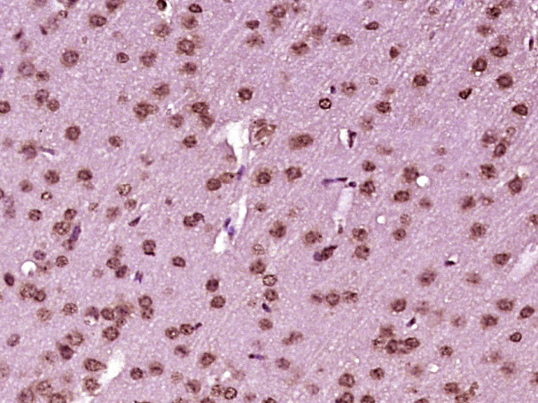 DHX33 Antibody in Immunohistochemistry (Paraffin) (IHC (P))