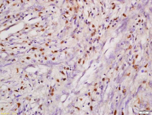 DHX8 Antibody in Immunohistochemistry (Paraffin) (IHC (P))