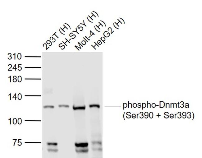 Phospho-Dnmt3a (Ser390, Ser393) Antibody in Western Blot (WB)