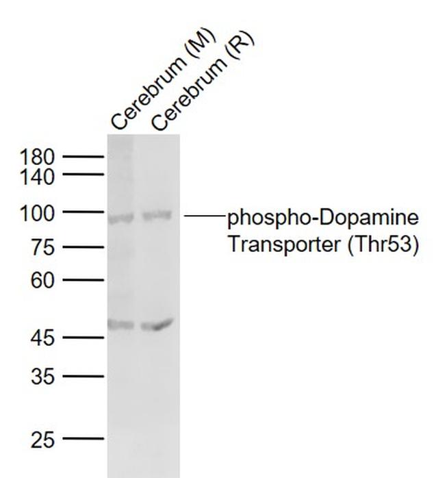 Phospho-Dopamine Transporter (Thr53) Antibody in Western Blot (WB)