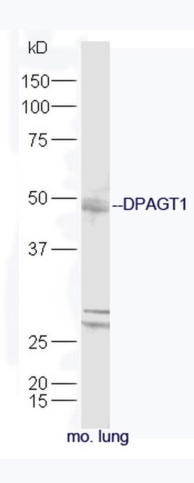 DPAGT1 Antibody in Western Blot (WB)