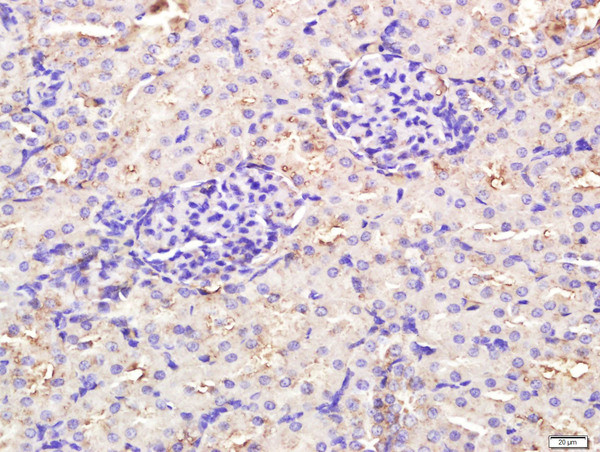 TLR3 Antibody in Immunohistochemistry (Paraffin) (IHC (P))