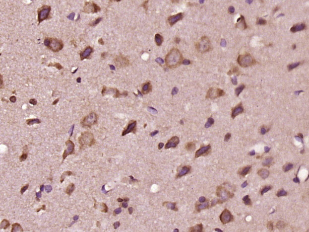 EDEM3 Antibody in Immunohistochemistry (Paraffin) (IHC (P))