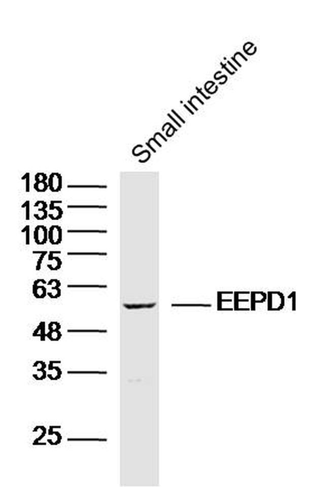 EEPD1 Antibody in Western Blot (WB)