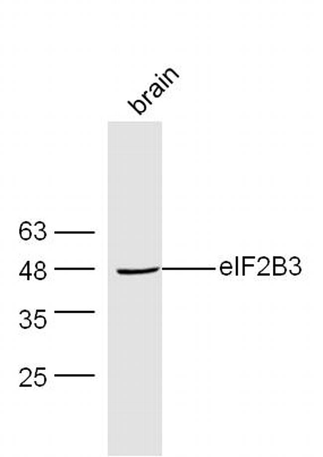 EIF2B3 Antibody in Western Blot (WB)