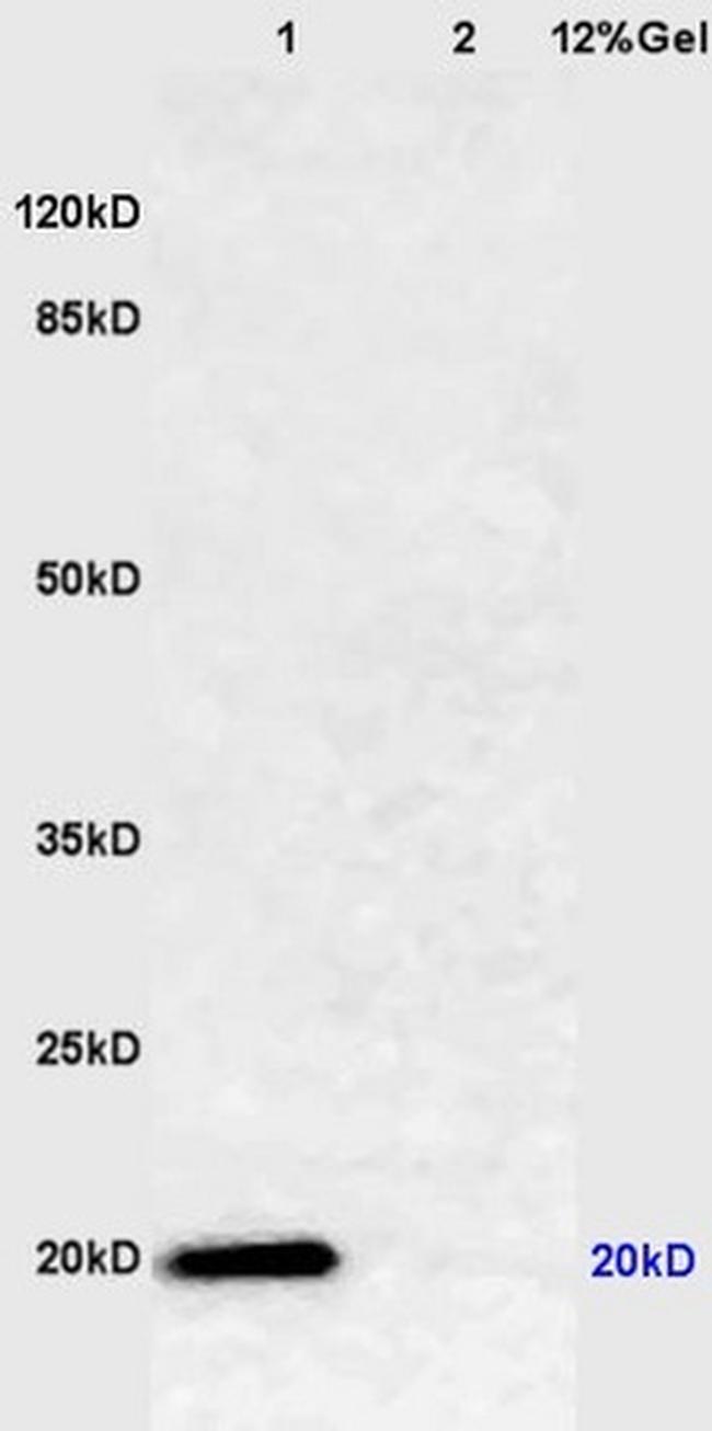 Caveolin-1 Antibody in Western Blot (WB)