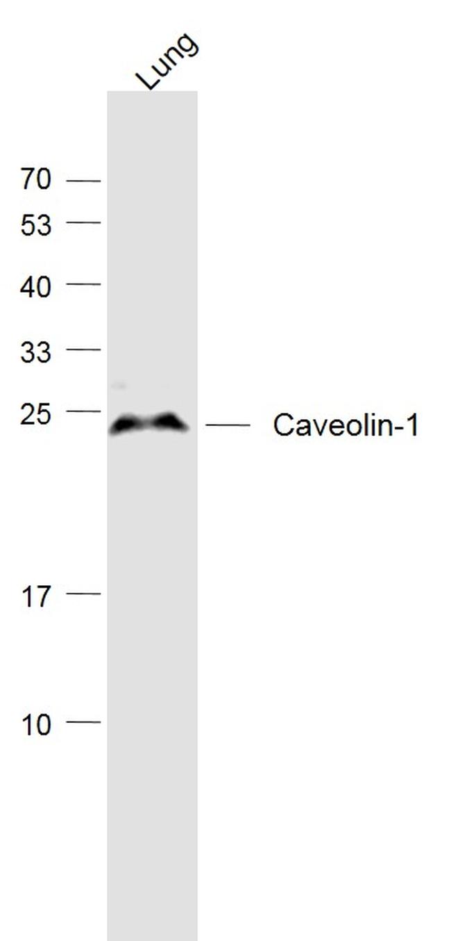 Caveolin-1 Antibody in Western Blot (WB)