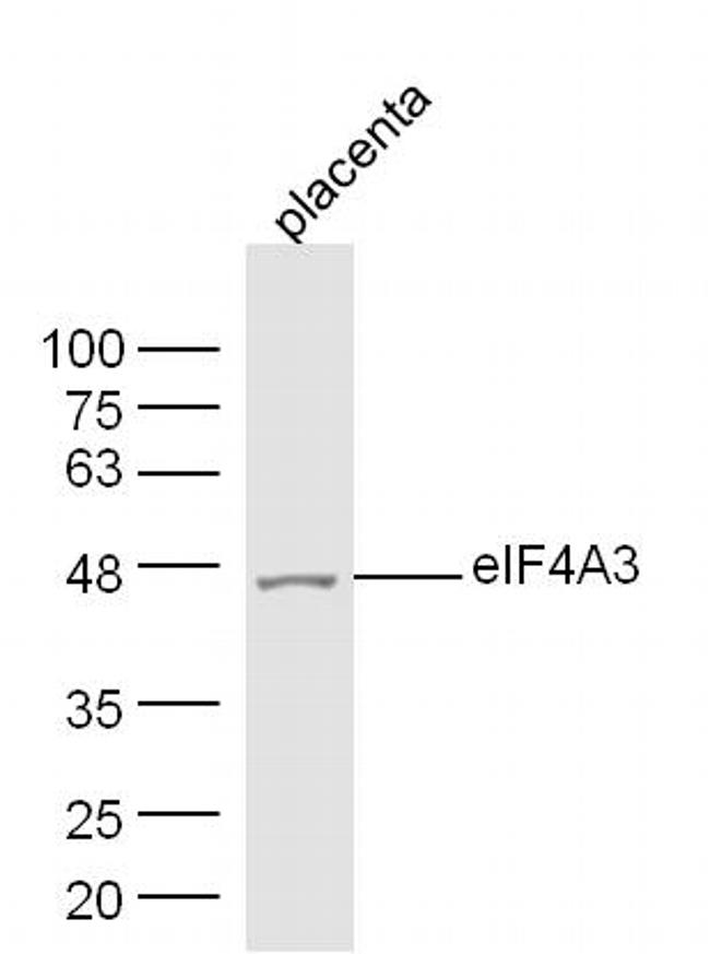 eIF4A3 Antibody in Western Blot (WB)