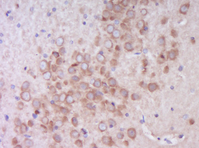 Phospho-EIF4B (Ser406) Antibody in Immunohistochemistry (Paraffin) (IHC (P))