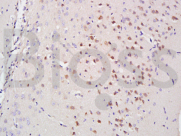 A2AR/Adenosine A2a receptor Antibody in Immunohistochemistry (Paraffin) (IHC (P))