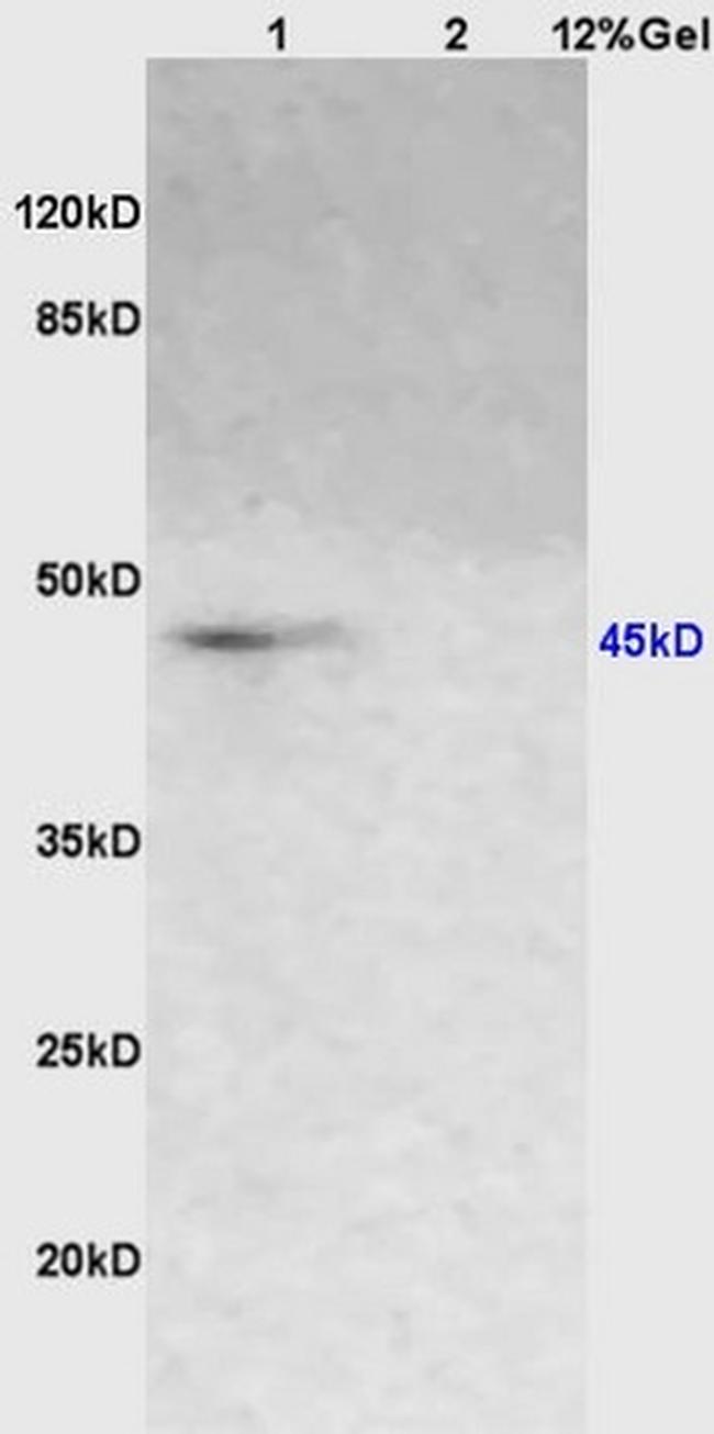 A2AR/Adenosine A2a receptor Antibody in Western Blot (WB)