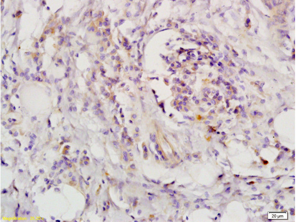 LIFR/CD118 Antibody in Immunohistochemistry (Paraffin) (IHC (P))