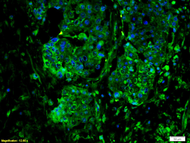 IL-6R Beta/CD130/gp130 Antibody in Immunohistochemistry (Paraffin) (IHC (P))