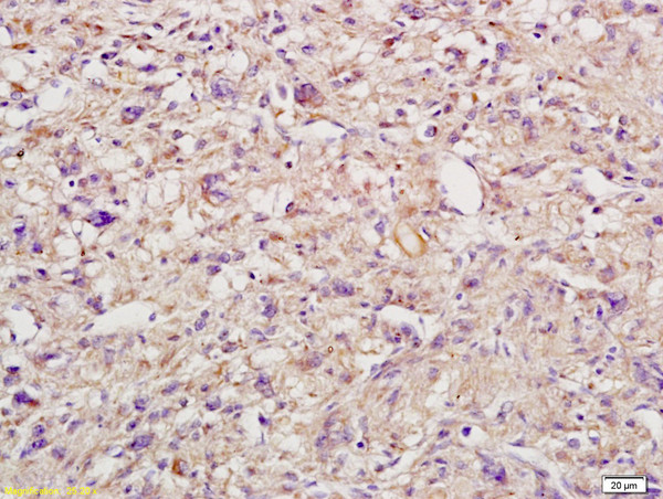 IL-6R Beta/CD130/gp130 Antibody in Immunohistochemistry (Paraffin) (IHC (P))