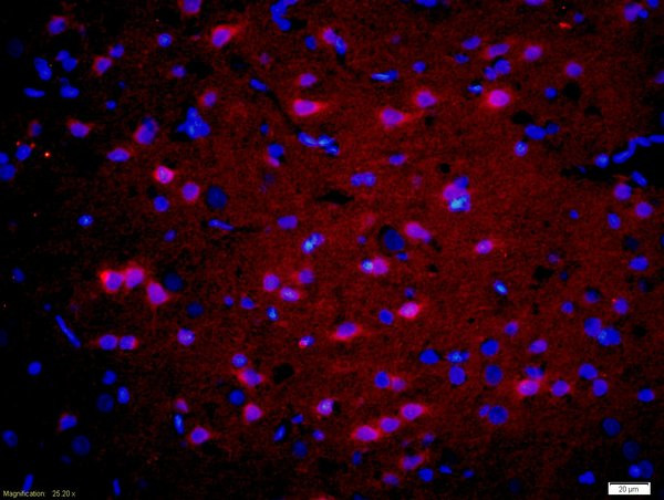 GnRHR Antibody in Immunohistochemistry (Paraffin) (IHC (P))