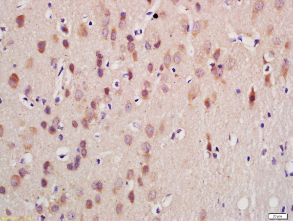 GnRHR Antibody in Immunohistochemistry (Paraffin) (IHC (P))